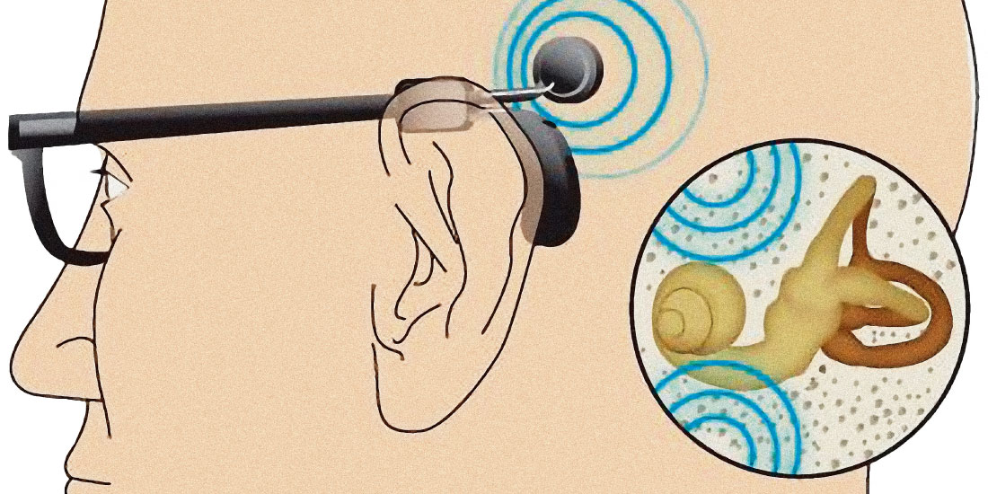 科技 贝多芬 日本 骨传导 罗姆