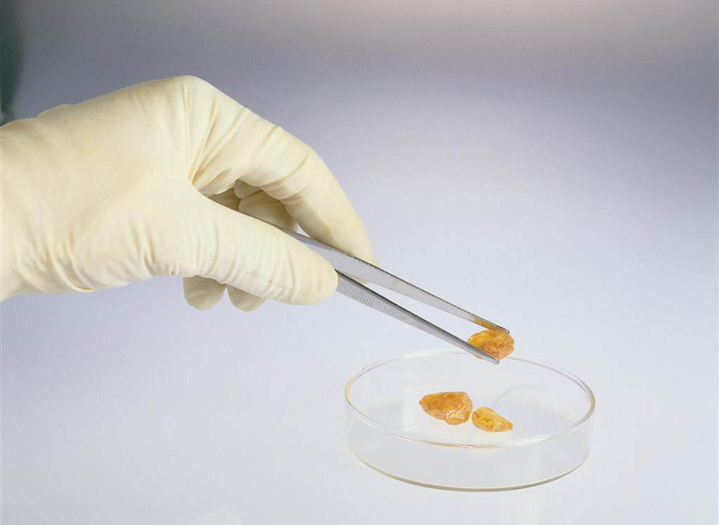 WBA计划迎娶的Rite Aid连锁药店，凭什么值172亿美元？