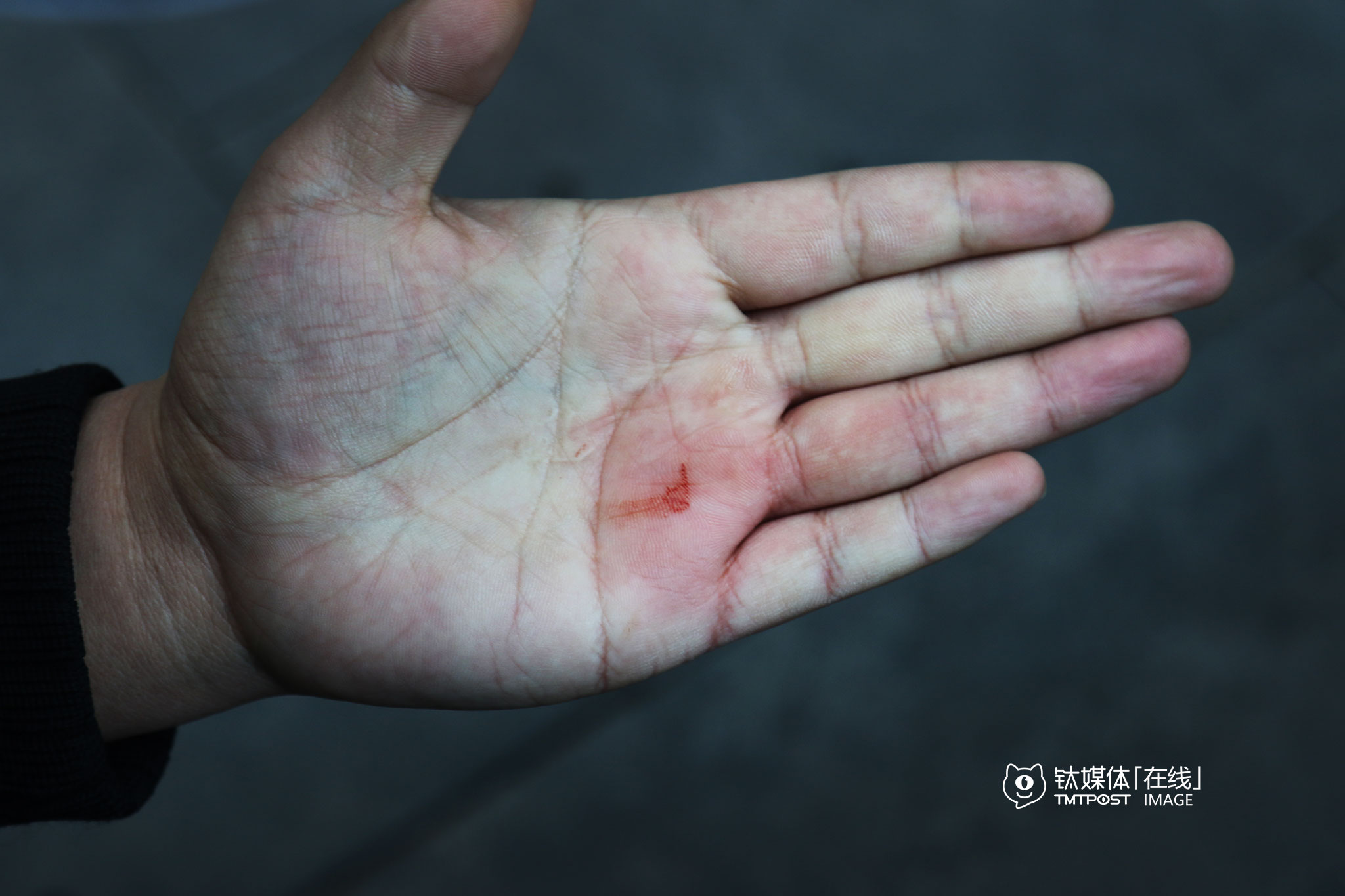 训练时，在回答狗狗主人的问题时分了一下神，海哲被这只泰迪咬了一口，干这行8年，他被咬过不少次。被咬了之后，旁边的狗主人不停道歉，海哲解释说，狗咬人不是狗的问题，一定是人的问题，它咬人肯定是有原因的，“它刚才在训练时的挫折感没处挥发，所以很紧张，肌肉一直在抖动，这时就很容易咬人，加上我说话一不留心分了一下神，它抓住机会就咬了。”