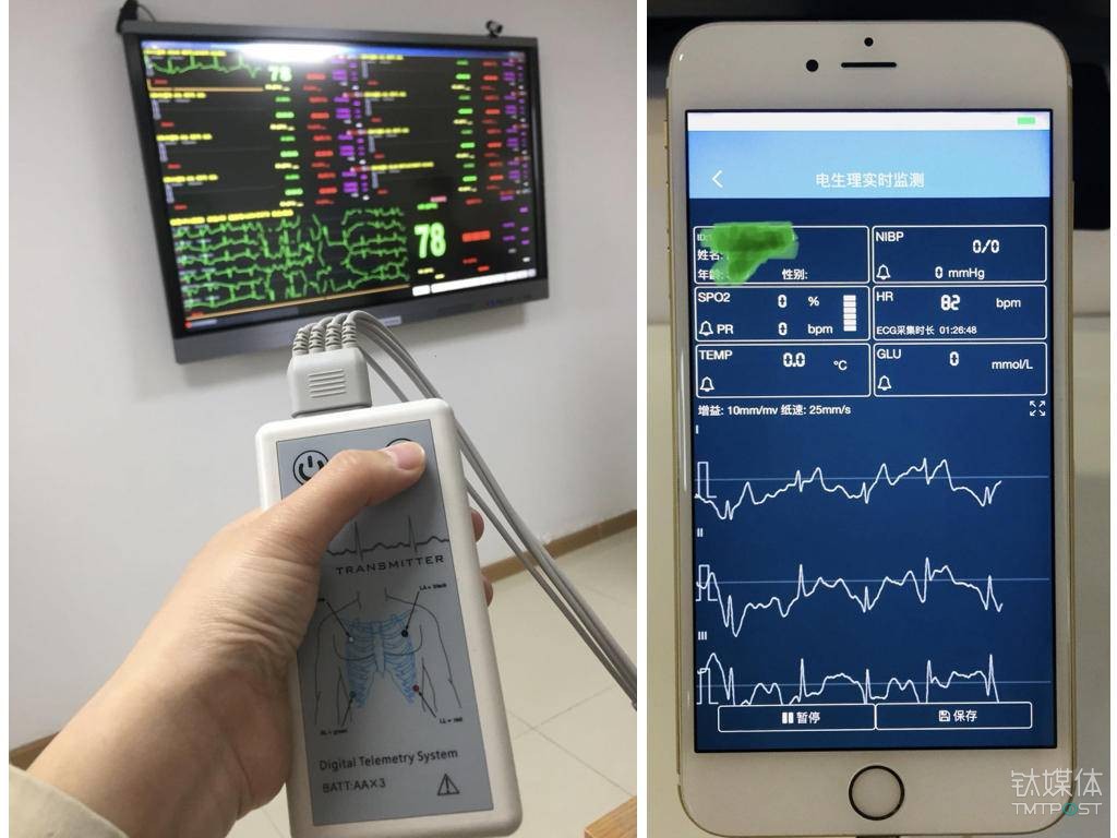 左图测心电图的仪器，可以投射到大屏幕上；右图为医生端的心电实施检测软件（图：钛媒体编辑 付梦雯）