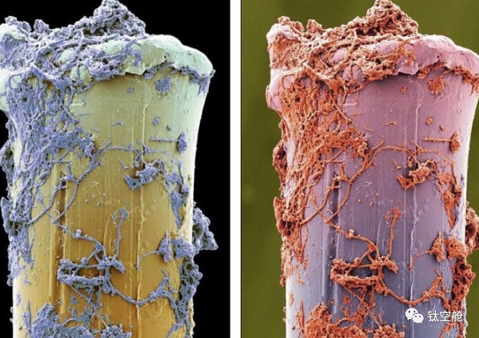 每天用的牙刷竟然有上百万细菌怎么办