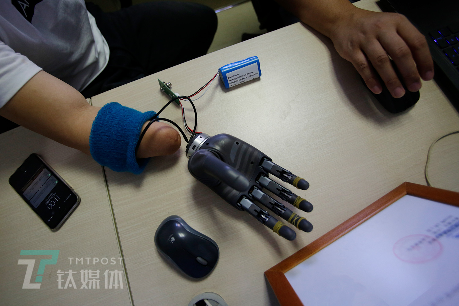 5月22日，上海，倪敏成在测试BrainRobotics的肌电假手，为制作接收腔做准备。