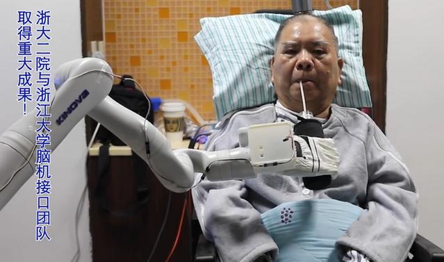 利用植入式脑机接口，72岁高位截瘫患者用意念打麻将
