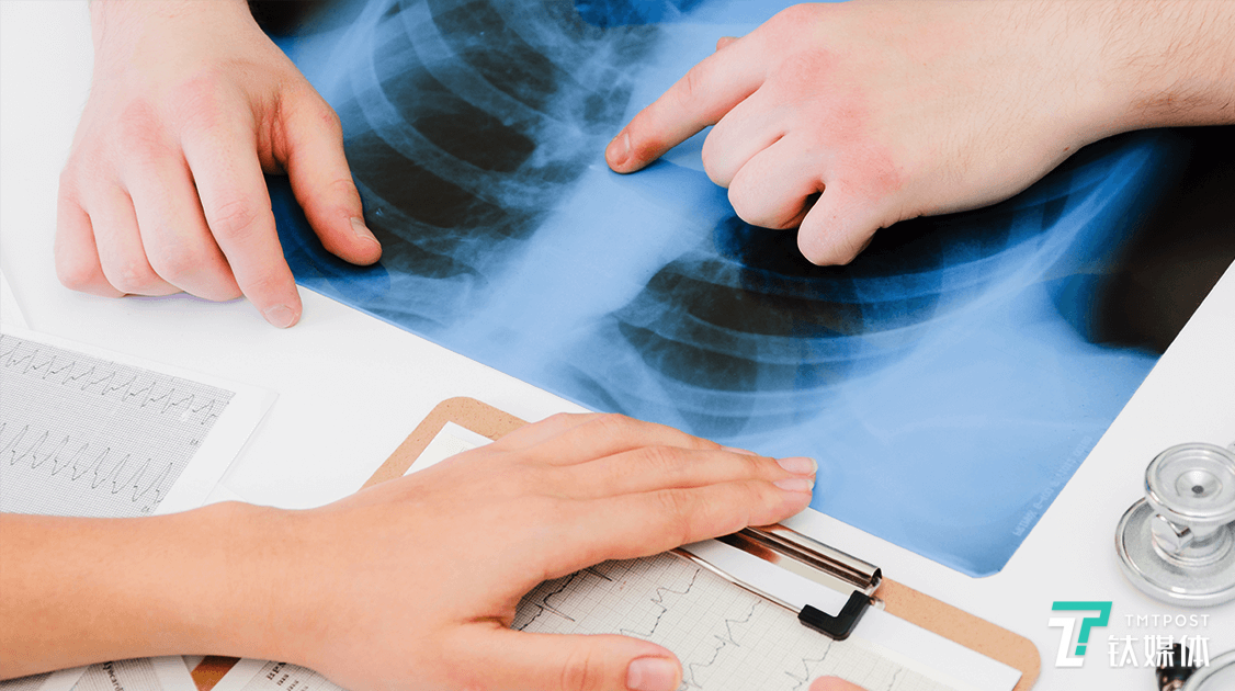 与时间赛跑，CT影像能否完全替代核酸筛查新冠肺炎？