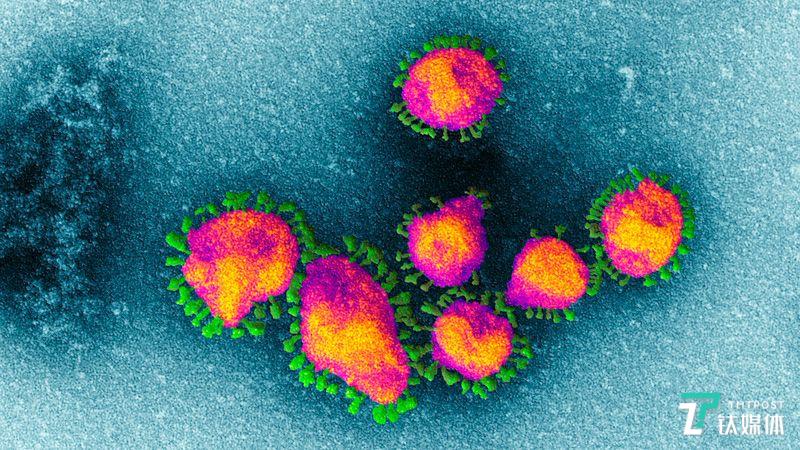 中外专家：穿山甲或是新冠病毒的中间宿主｜钛媒体科普