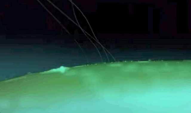 Neuralink打孔器干起活来有点像缝纫机