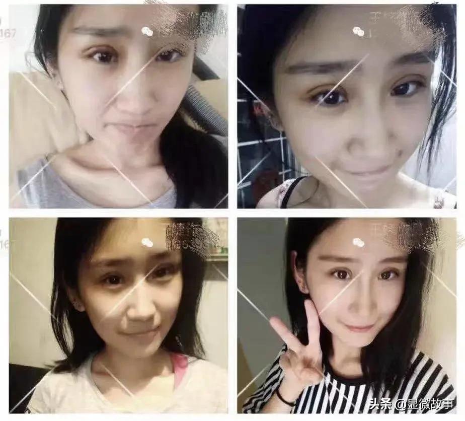 图 | 手术恢复期