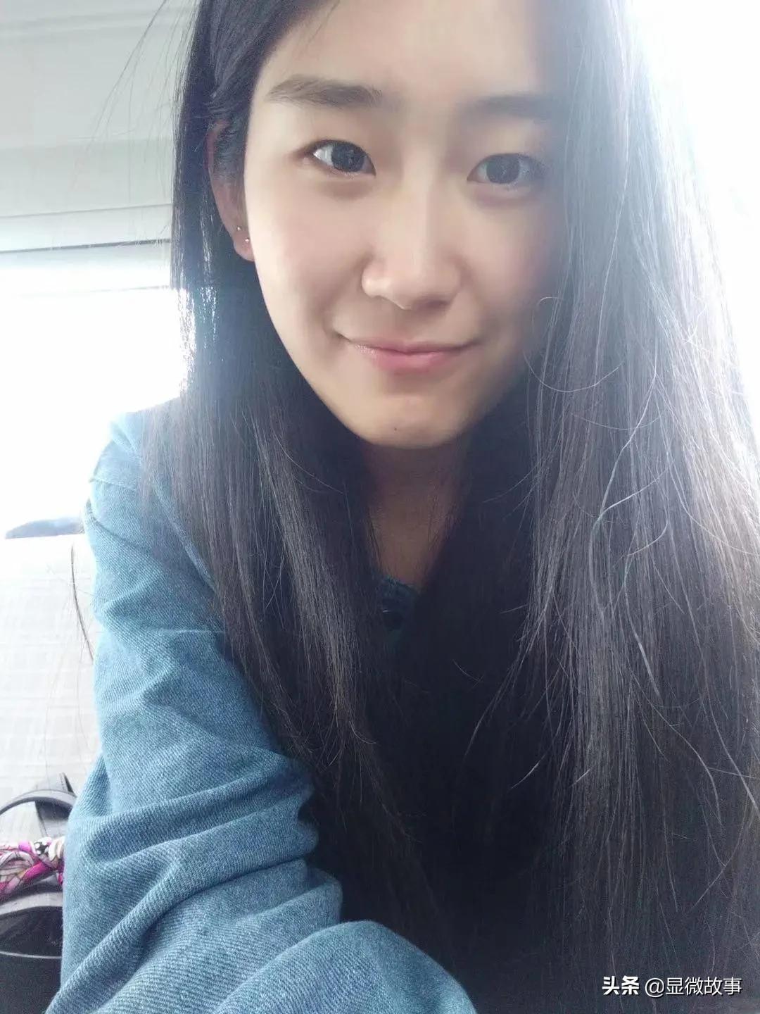 图 | 单眼皮时候的照片