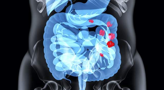 粪菌移植的背后，肠道菌那些你不知道的事儿