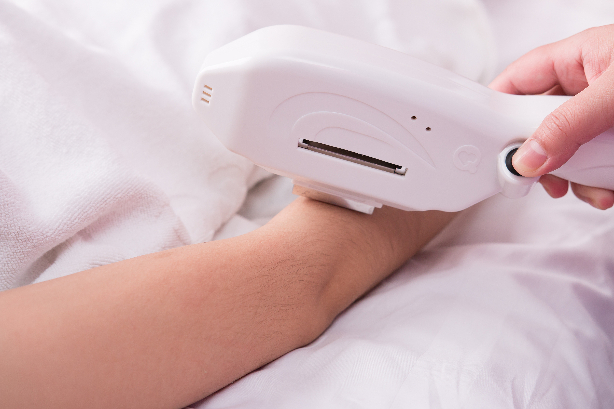 脱毛仪市场也疯狂