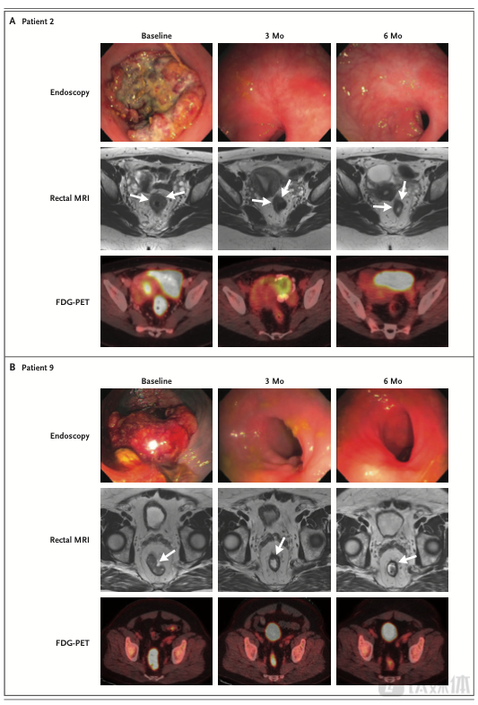 临床试验6个月后，扫描结果中已经恢复了光滑的粉红色组织（来源：论文）