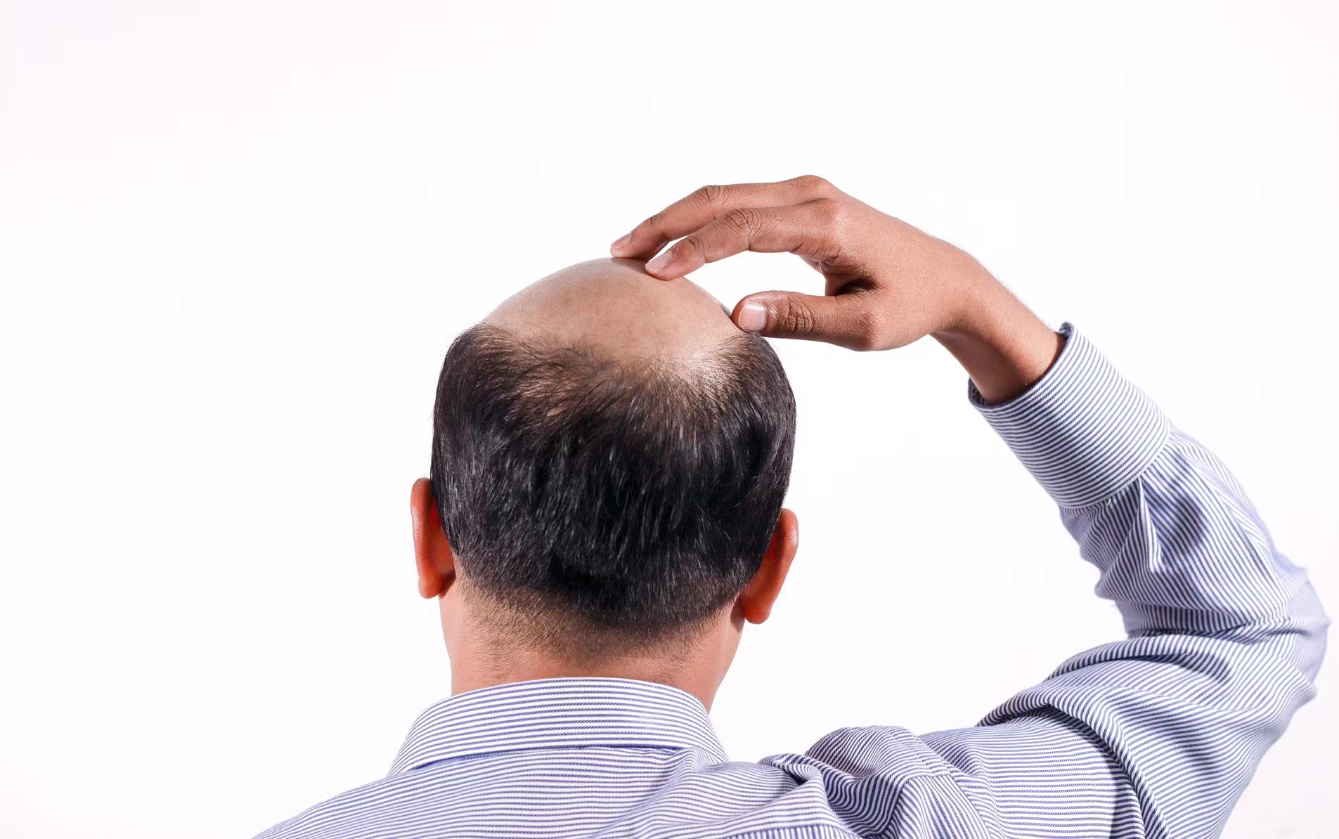 大麦植发赴港IPO：毛利率高达70%，开拓“养固一体化”模式 | IPO速递