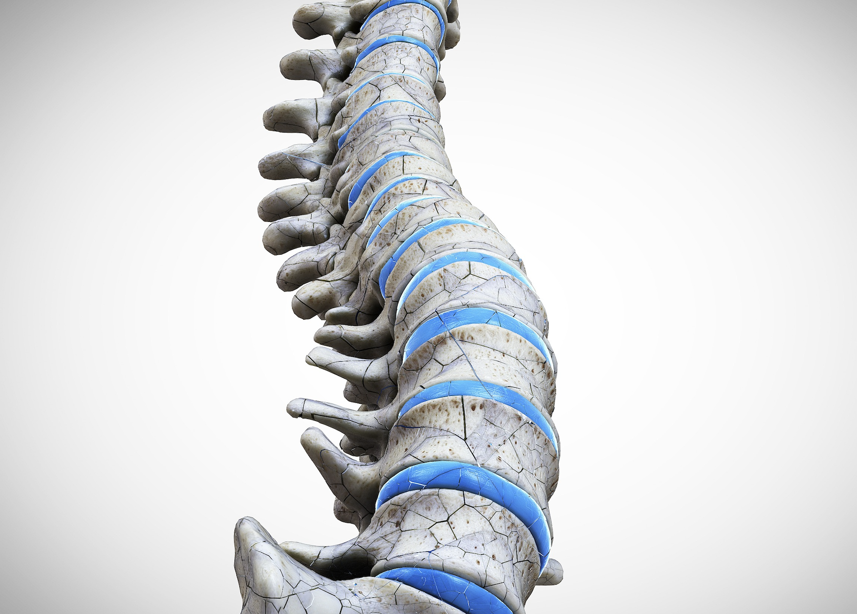 脊柱国采开标，威高又成最大赢家，哪些赛道仍是集采避风港？