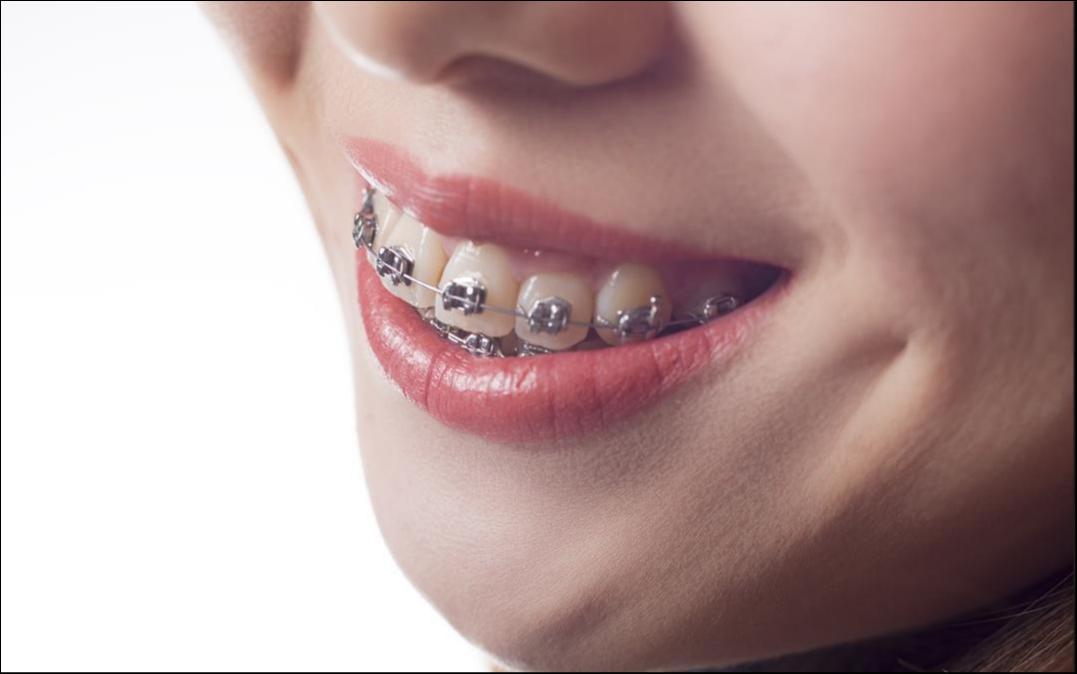 我，月薪一万，整不起牙