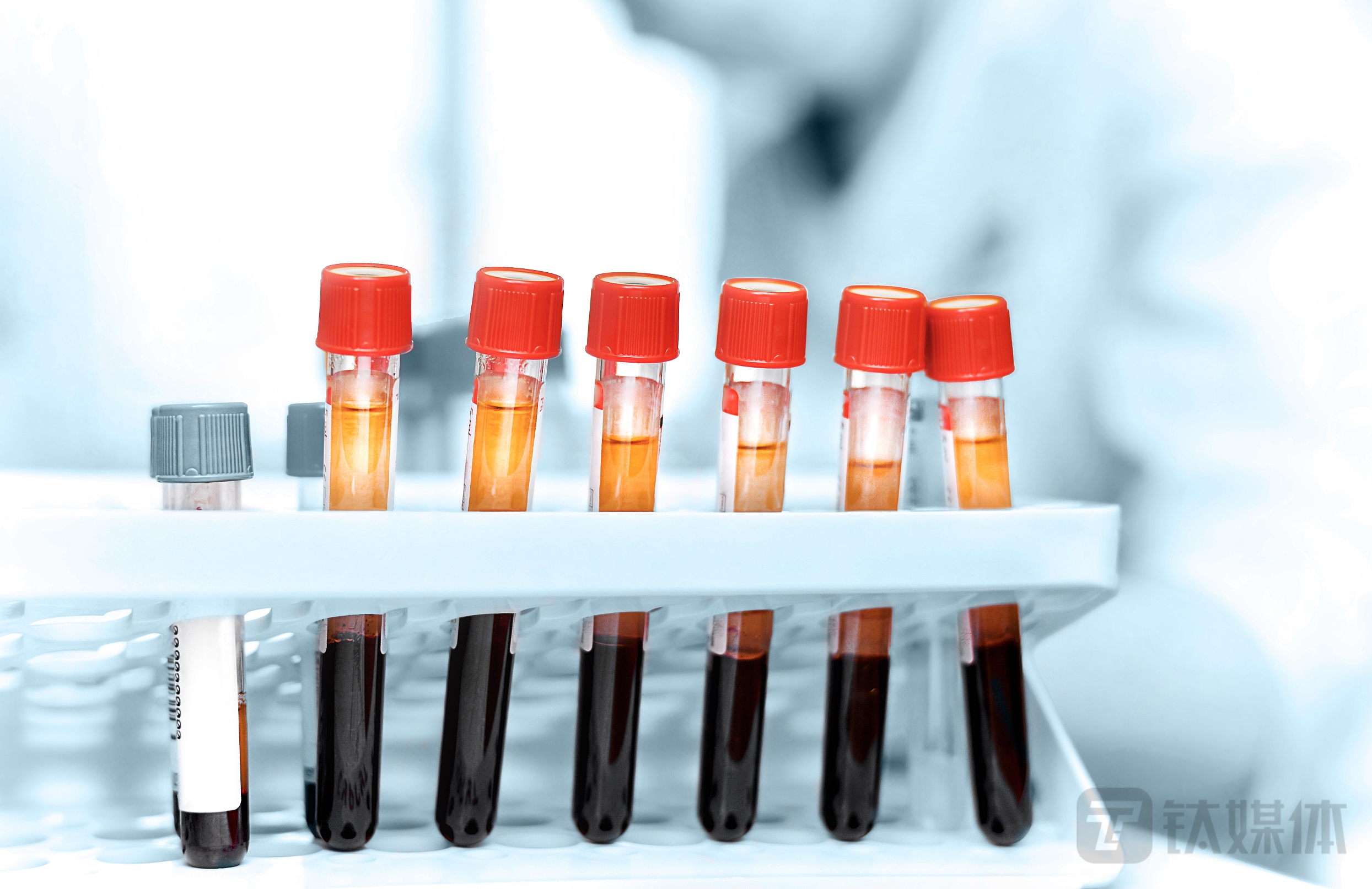 济南高新欲转型医疗：定增近4亿元“输血”现金流，矿业依旧是业绩主力