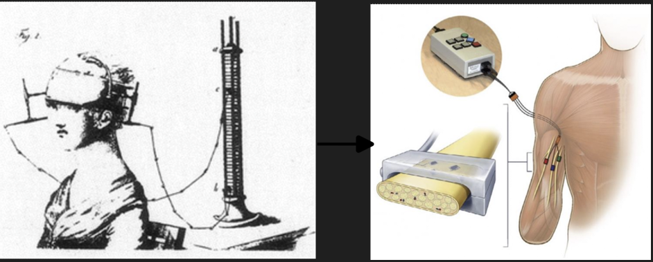 利用电刺激模拟触觉，让假肢变得更自然