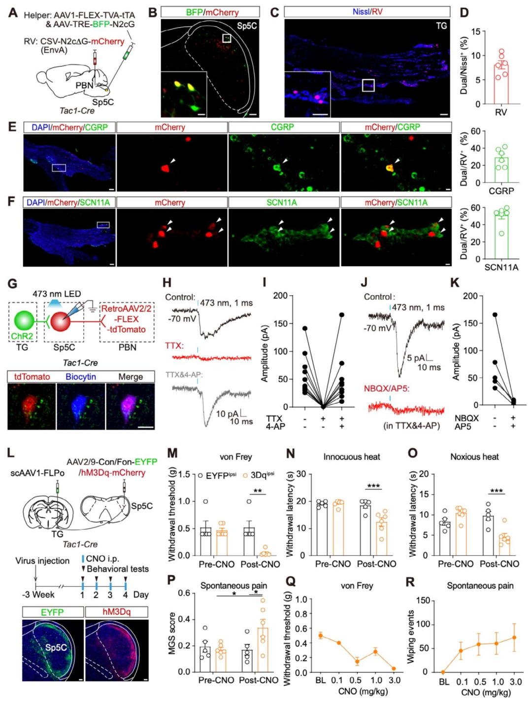 Adv Sci：复旦大学邓娟/孙立婷团队鉴定出介导三叉神经痛发病的神经环路