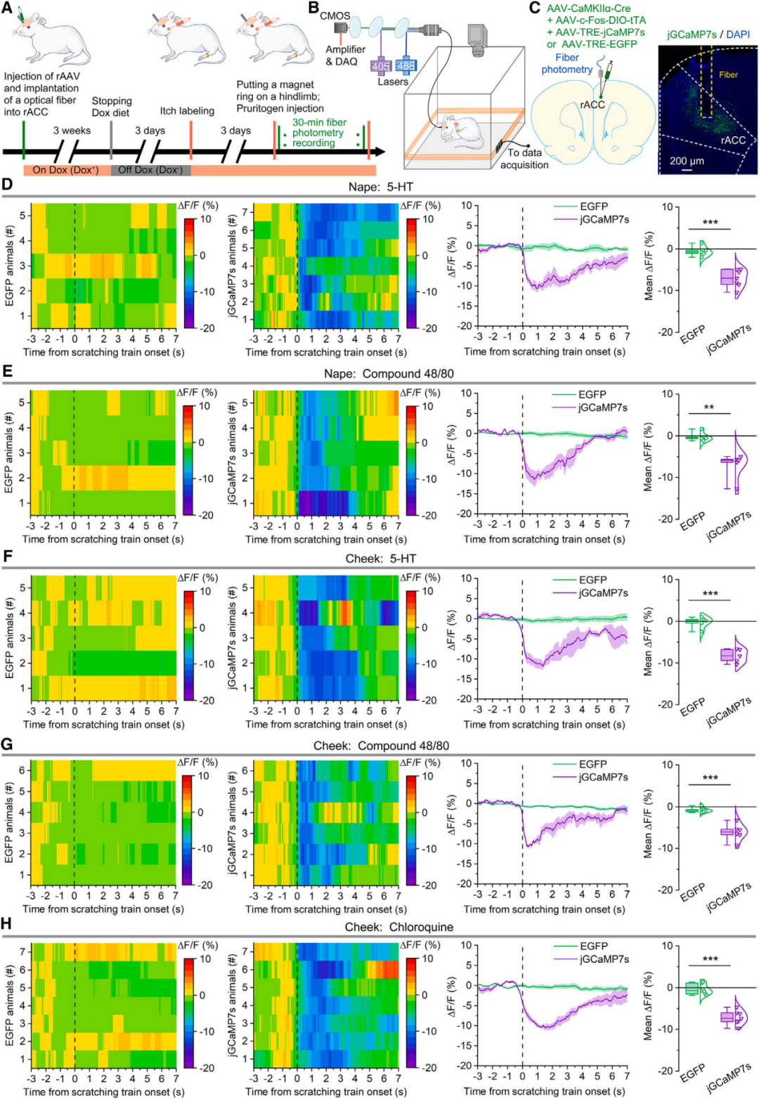 痒到抓狂？陆军医隋建峰/李红丽/吴广延团队发现抑制瘙痒的关键神经环路，为治疗慢性瘙痒提供新靶点
