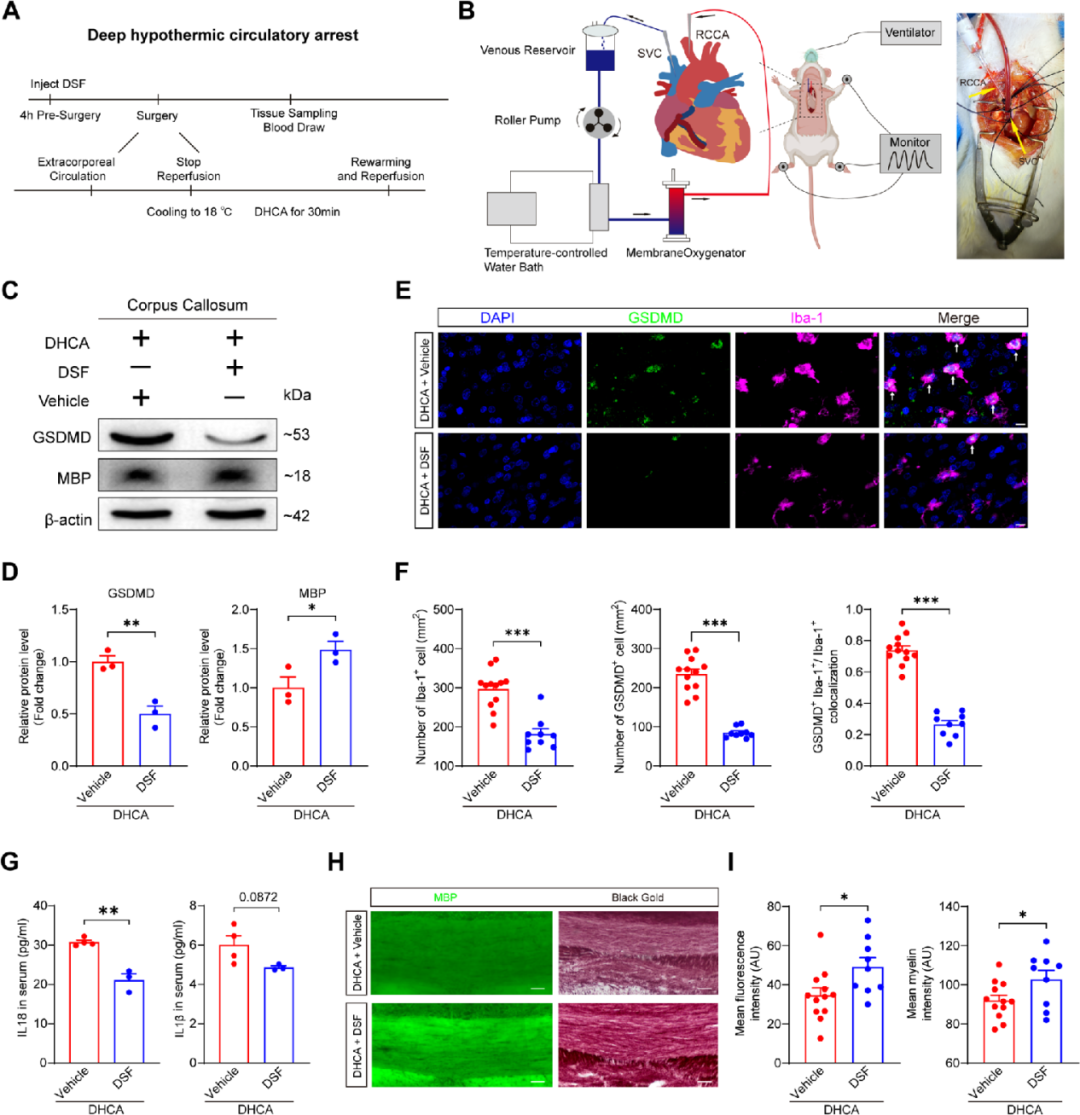 Neurosci Bull：上海交通大学祝忠群/童小萍团队揭示新生儿心脏术后脑损伤新机制