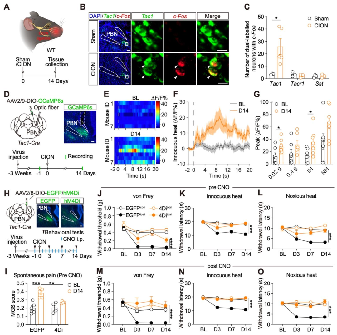 Adv Sci：复旦大学邓娟/孙立婷团队鉴定出介导三叉神经痛发病的神经环路