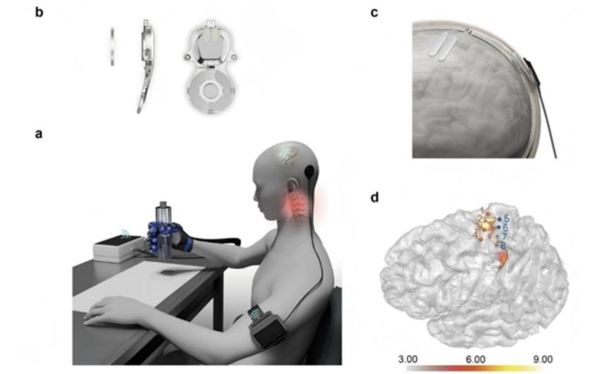 BCI's Smokeless Algorithm Wars