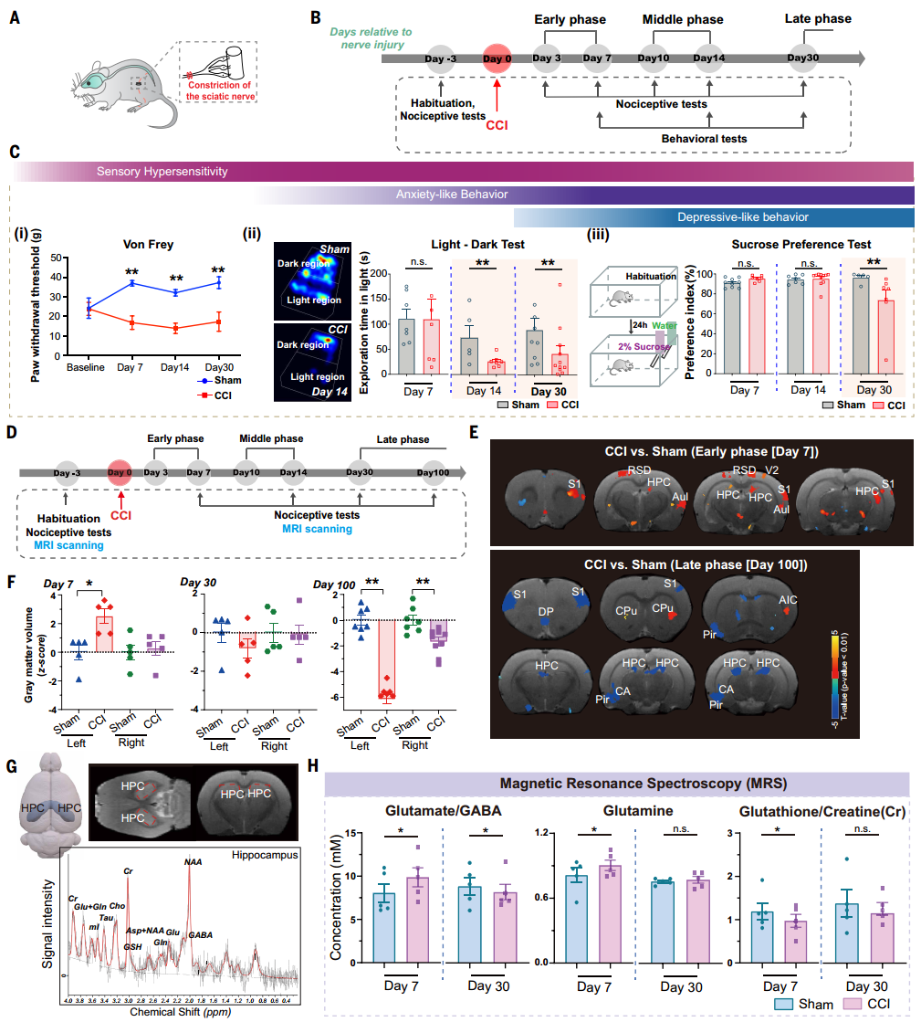 复旦+剑桥联手登Science！首次破解疼痛致抑郁的关键机制，别让疼痛熬成抑郁！