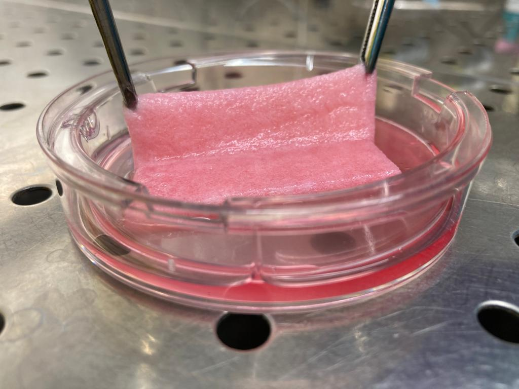 HekeTiss Develops Stem Cell Patch for Chronic Ulcers