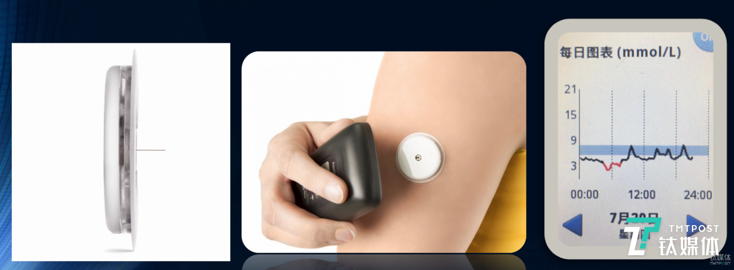 圖為雅培輔理善瞬感系統(tǒng)，從左到右依次為傳感器、血糖掃描儀、數(shù)據(jù)顯示屏幕